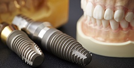 Parts of dental implants in Roselle Park