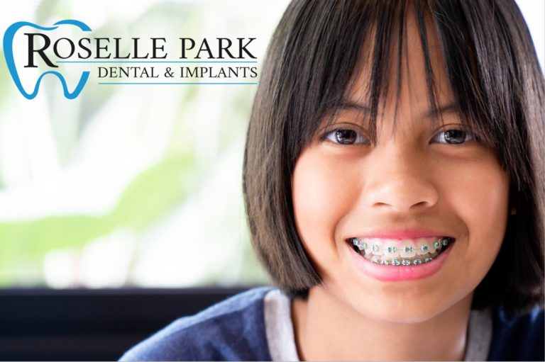 orthodontics-can-beautifully-straighten-your-child-s-smile-roselle