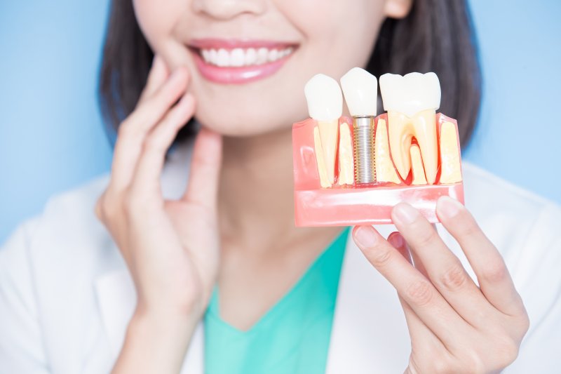 A smiling dentist holding an enlarged dental implant model